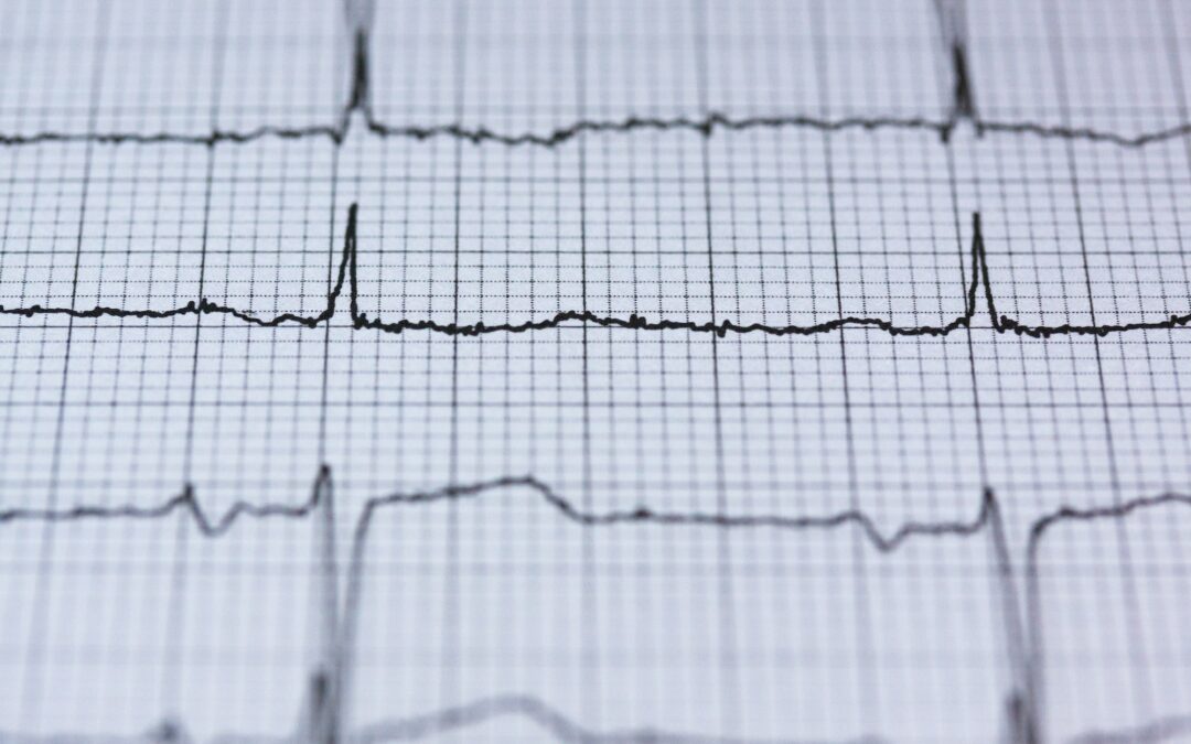 Een radiografiek, voorbeeld van een pulse survey