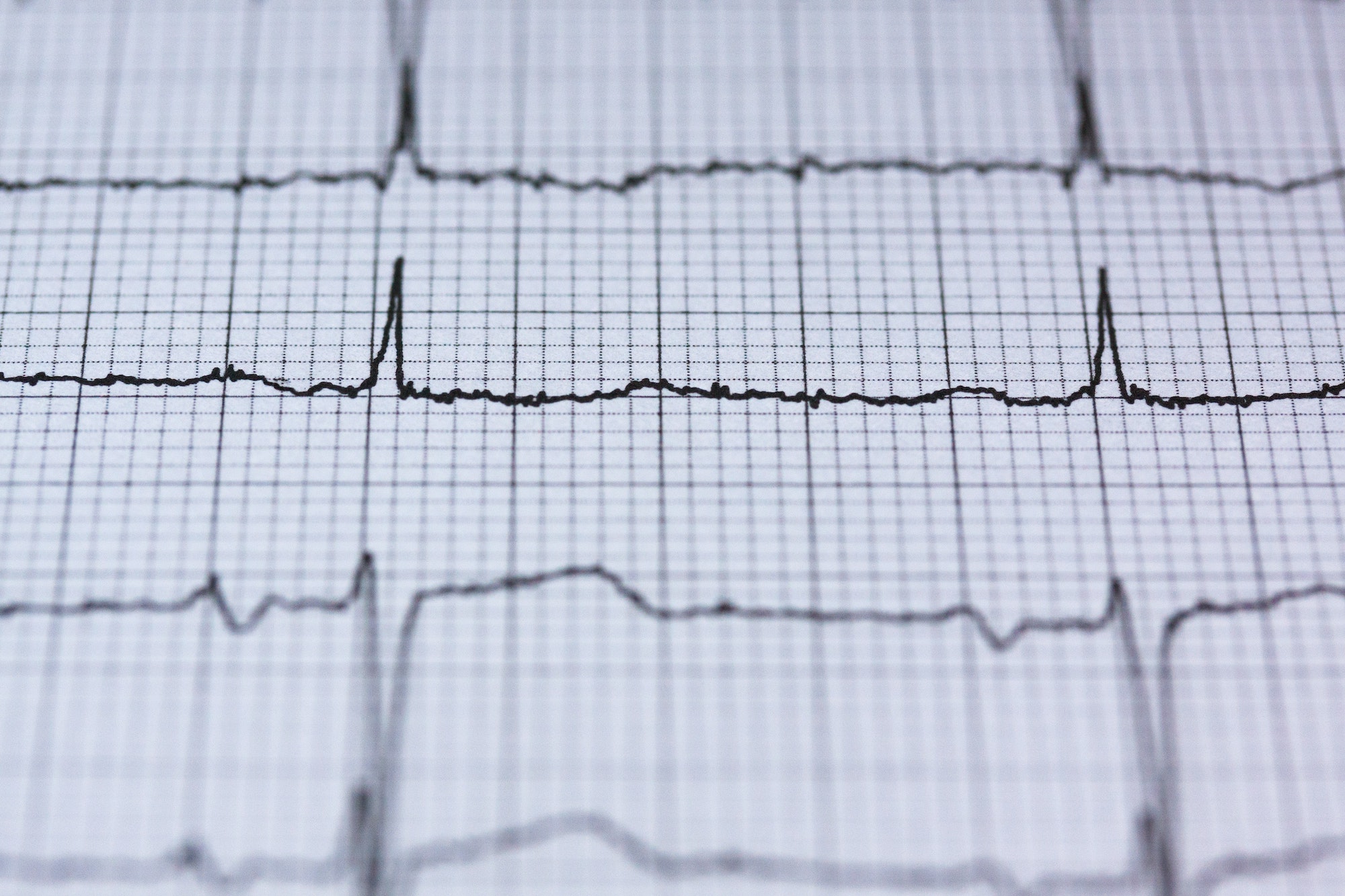 Een radiografiek, voorbeeld van een pulse survey